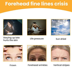 Forehead Wrinkle Patches (10 Pcs) – Anti-Aging Pads | GlowForm