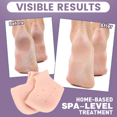 Silicone Heel Protectors – Anti-Crack Moisturizing Socks | Velvet Wellness