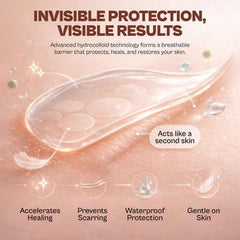 Pimple Patch Set Ð Accelerates Healing & Prevents Scarring