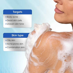 Salicylic Acid Body Wash – 1% Anti-Acne Exfoliating Gel