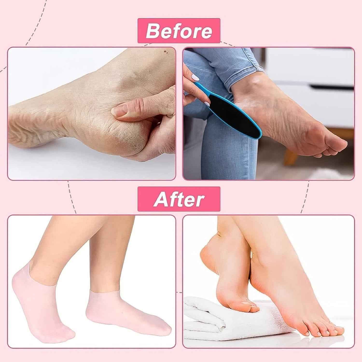 Silicone Moisturizing Socks – Softening Dry Cracked Feet