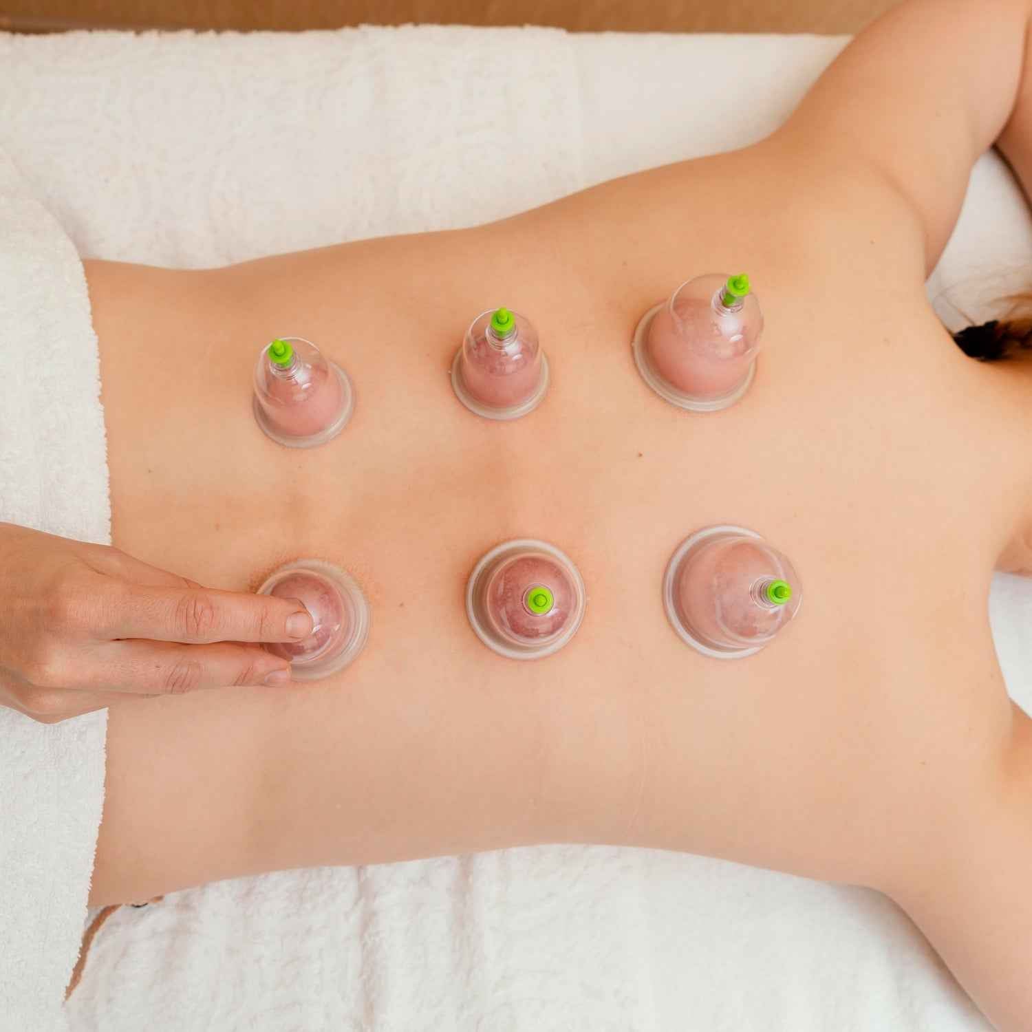 Vacuum Cupping Set – 6 Pc Muscle Relief Therapy Kit | Arrive Kit