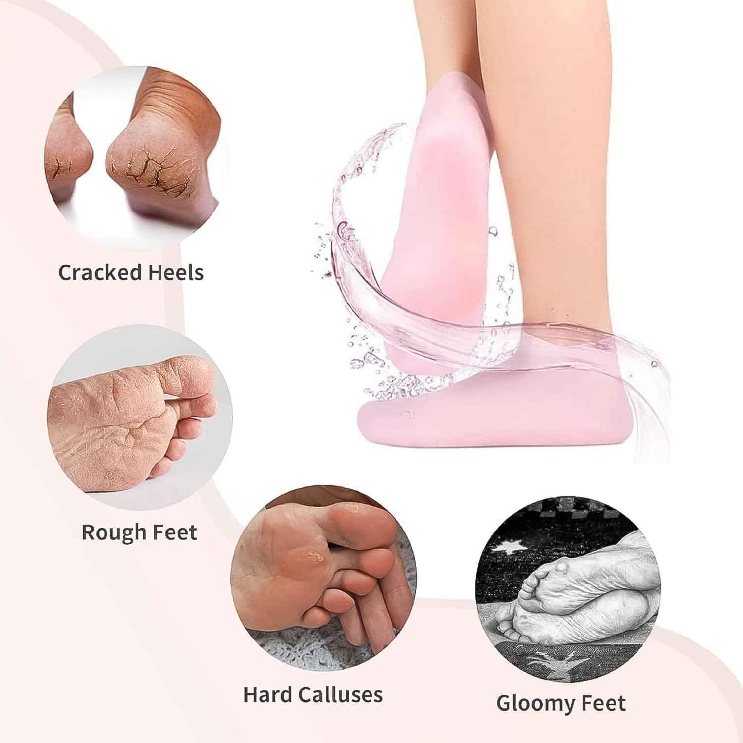 Silicone Moisturizing Socks – Softening Dry Cracked Feet