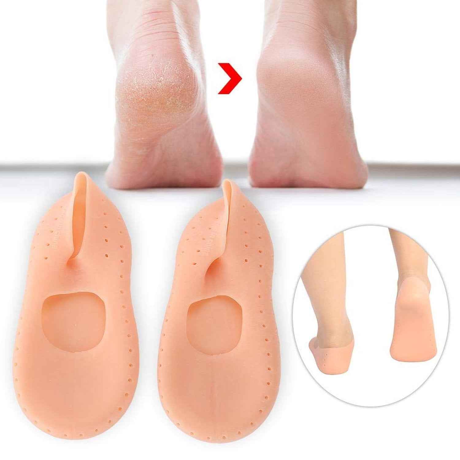 Pair of FitFuzion cracked heel socks, made of transparent silicone gel for foot protection.
