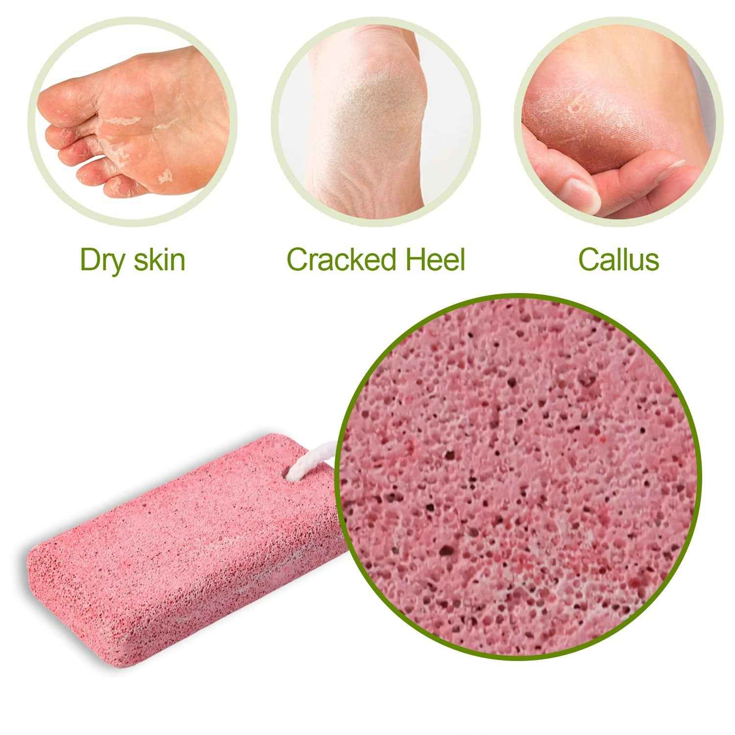 Foot Pumice Stone – Rectangular Dead Skin & Callus Remover
