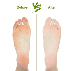 Foot Pumice Stone – Rectangular Dead Skin & Callus Remover